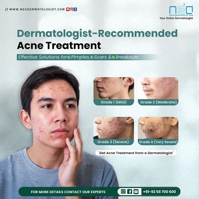 Dermatologist-Recommended Acne Treatment, Effective Solutions for Pimples, Scars & Breakouts - Get Acne Treatment from a Dermatologist
