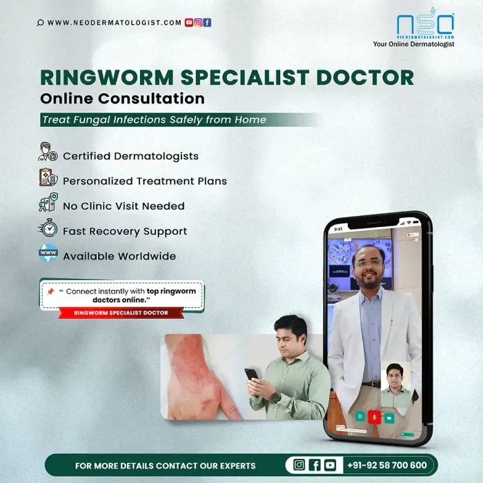 Ringworm Specialist Doctor - Get Ringworm Treatment Online At Neodermatologist