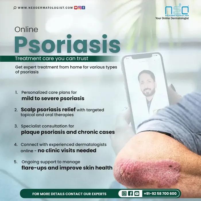 Online Psoriasis Treatment Care You Can Trust - Get expert treatment from home for various types of psoriasis at Neodermatologist
