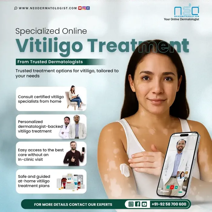 Specialized Online Vitiligo Treatment (विटिलिगो रोग का ऑनलाइन उपचार) from Trusted Dermatologists