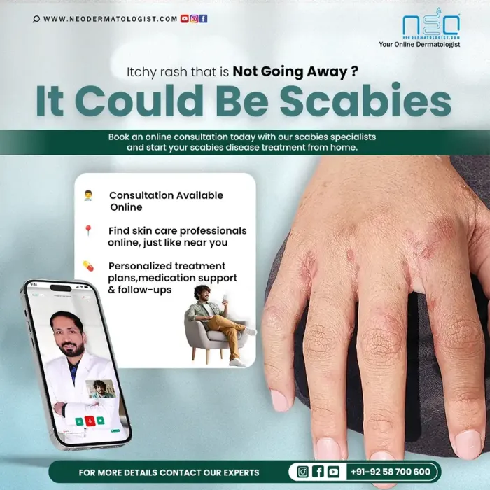 Online Scabies Disease Rash Treatment - Itchy Rash? It Could Be Scabies - Get Treatment by a Certified Dermatologist
