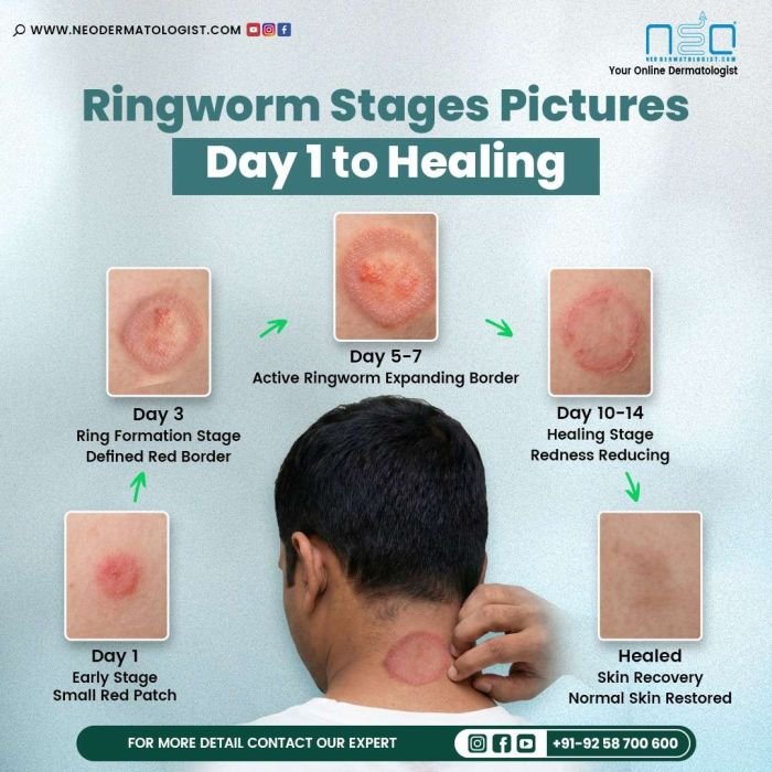 Skin & Hair Treatment Gallery & Videos | Neodermatologist