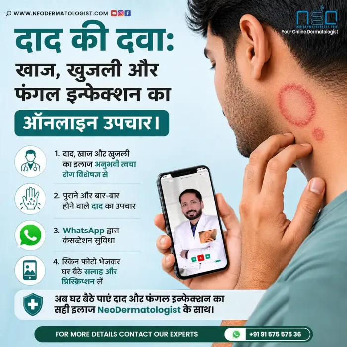 दाद की दवाई (Dad Ki Dawa) और फंगल इन्फेक्शन के ऑनलाइन उपचार हेतु त्वचा विशेषज्ञ से परामर्श, जिसमें गर्दन पर दाद के संक्रमण वाला व्यक्ति NeoDermatologist के माध्यम से सलाह ले रहा है।