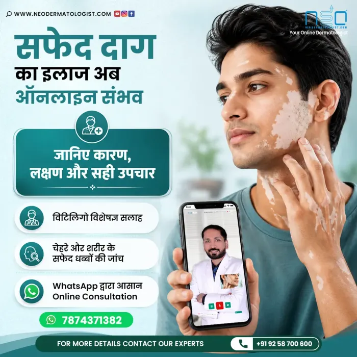 Online vitiligo specialist consultation for white skin patches with NeoDermatologist dermatology experts