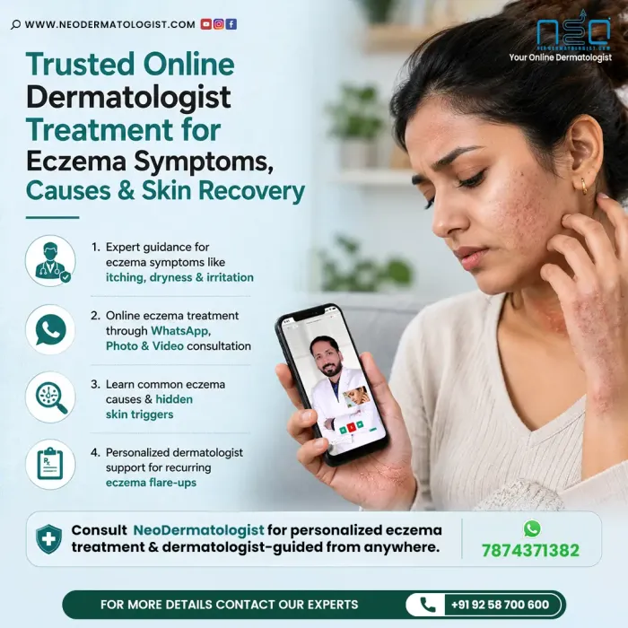 Eczema treatment online for eczema symptoms, causes and skin recovery by NeoDermatologist