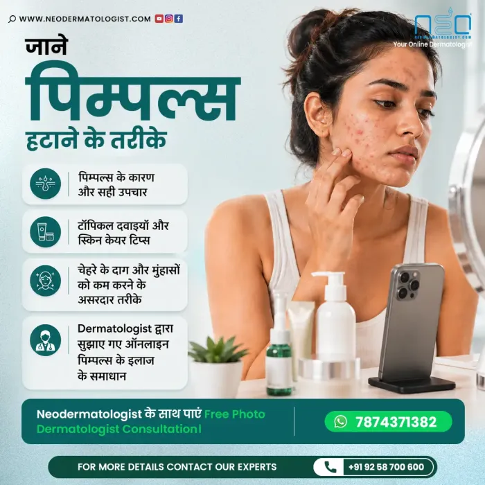 NeoDermatologist पर ऑनलाइन डर्मेटोलॉजिस्ट कंसल्टेशन के साथ पिंपल्स का सही इलाज जानें।