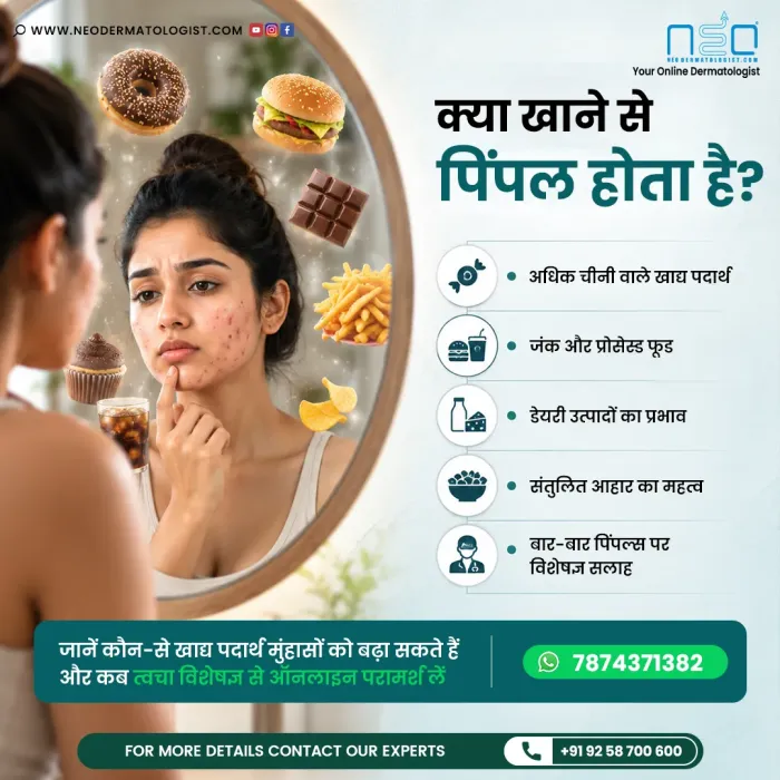 NeoDermatologist की ऑनलाइन त्वचा विशेषज्ञ सहायता के साथ मुँहासे और खान-पान के संबंध को समझें।