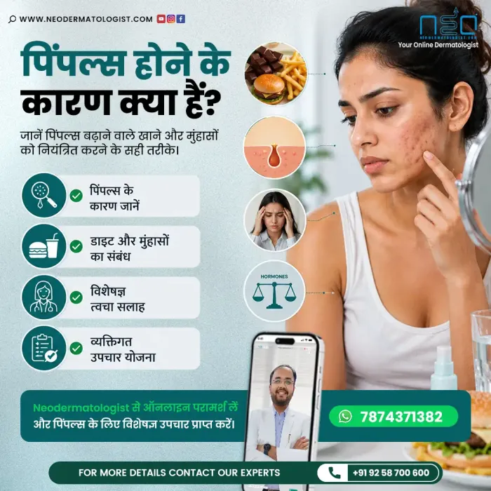 NeoDermatologist के सर्टिफ़ाइड डर्मेटोलॉजिस्ट डॉ. रुचिर शाह से पिंपल्स या मुँहासों के कारणों (pimple hone ke karan) के बारे में जानें।