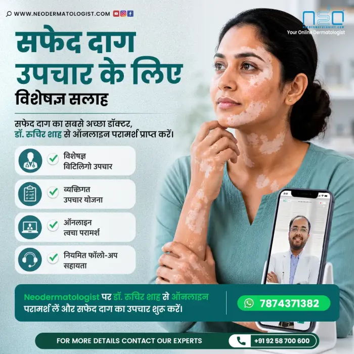 सफेद दाग के उपचार के लिए डॉ. रुचिर शाह से ऑनलाइन त्वचा विशेषज्ञ परामर्श – NeoDermatologist