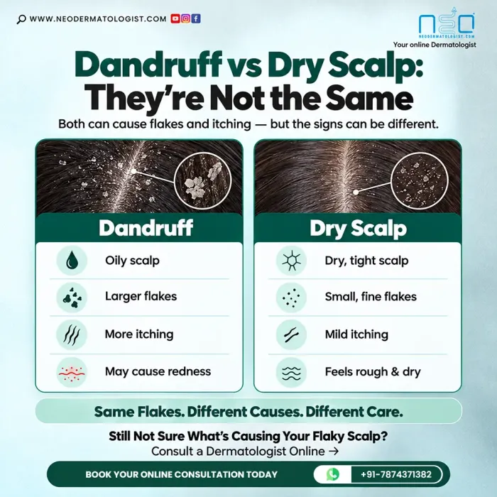 Dandruff vs Dry Scalp - Learn how oily flakes, dry skin, itching and scalp redness help distinguish these two conditions, with online consultation available at NeoDermatologist.