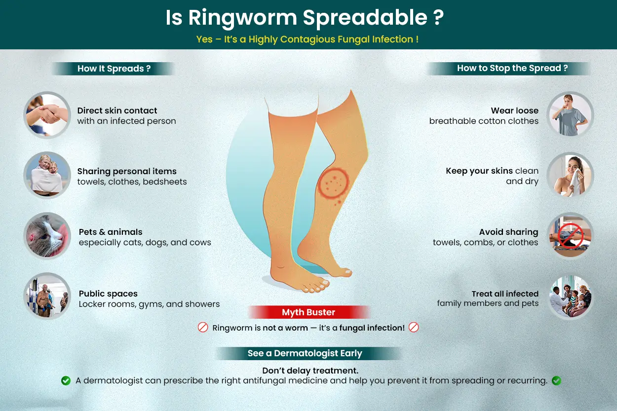 Is ringworm spreadable? is ringworm contagious? , How Ringworm Spreads