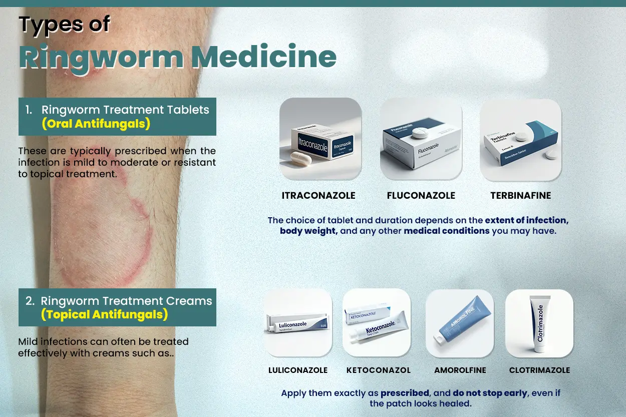 Types of Ringworm Medicine - Ringworm Treatment Tablets (Oral Antifungals), Ringworm Treatment Creams (Topical Antifungals)