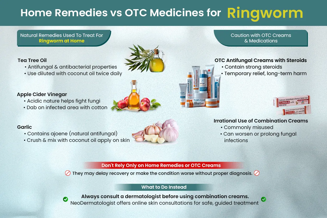 Home Remedies vs OTC Medicines for Ringworm - consult a dermatologist before using HOME REMEDIES OR OTC MEDICINES