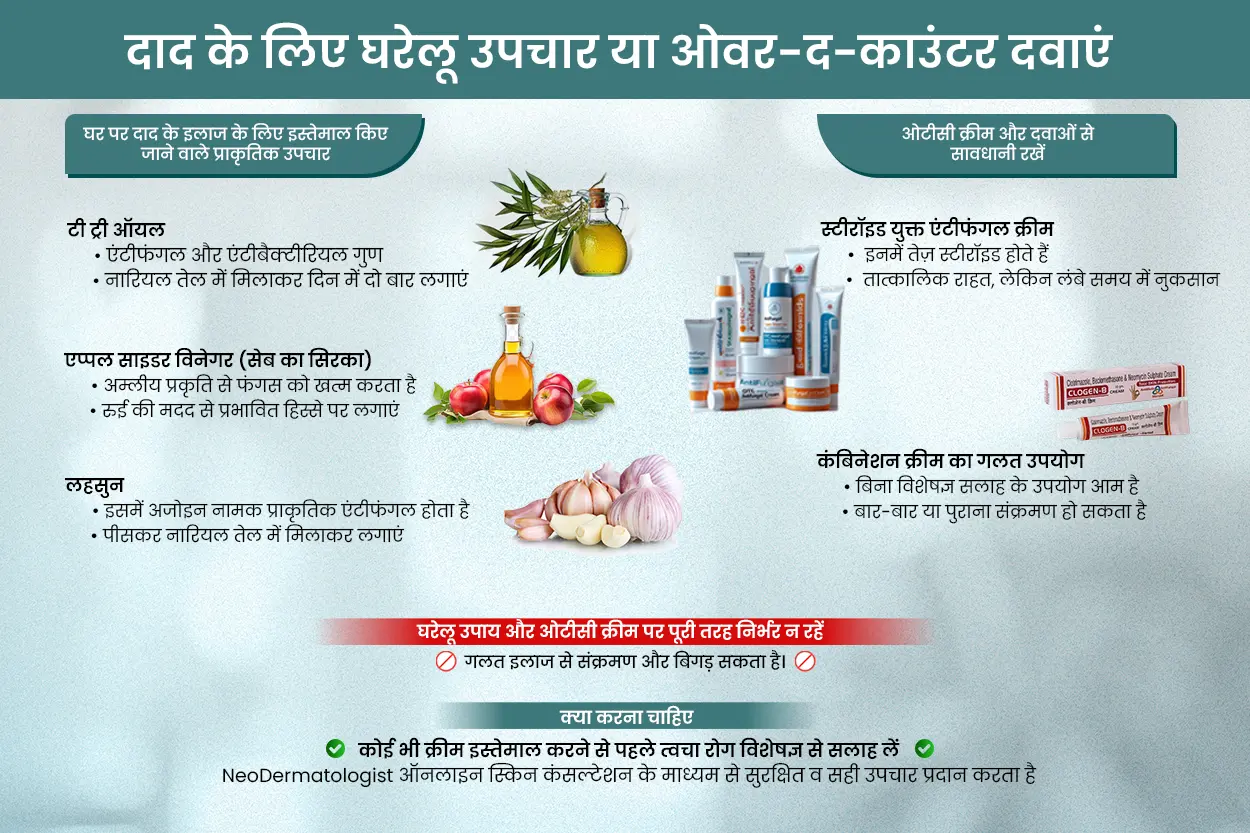 दाद के लिए घरेलू उपचार या ओवर-द-काउंटर दवाएं - घर पर दाद के इलाज के लिए इस्तेमाल किए जाने वाले प्राकृतिक उपचार