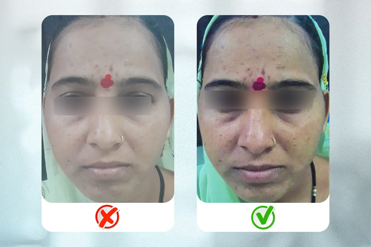 Embrace natural light - While taking photograph