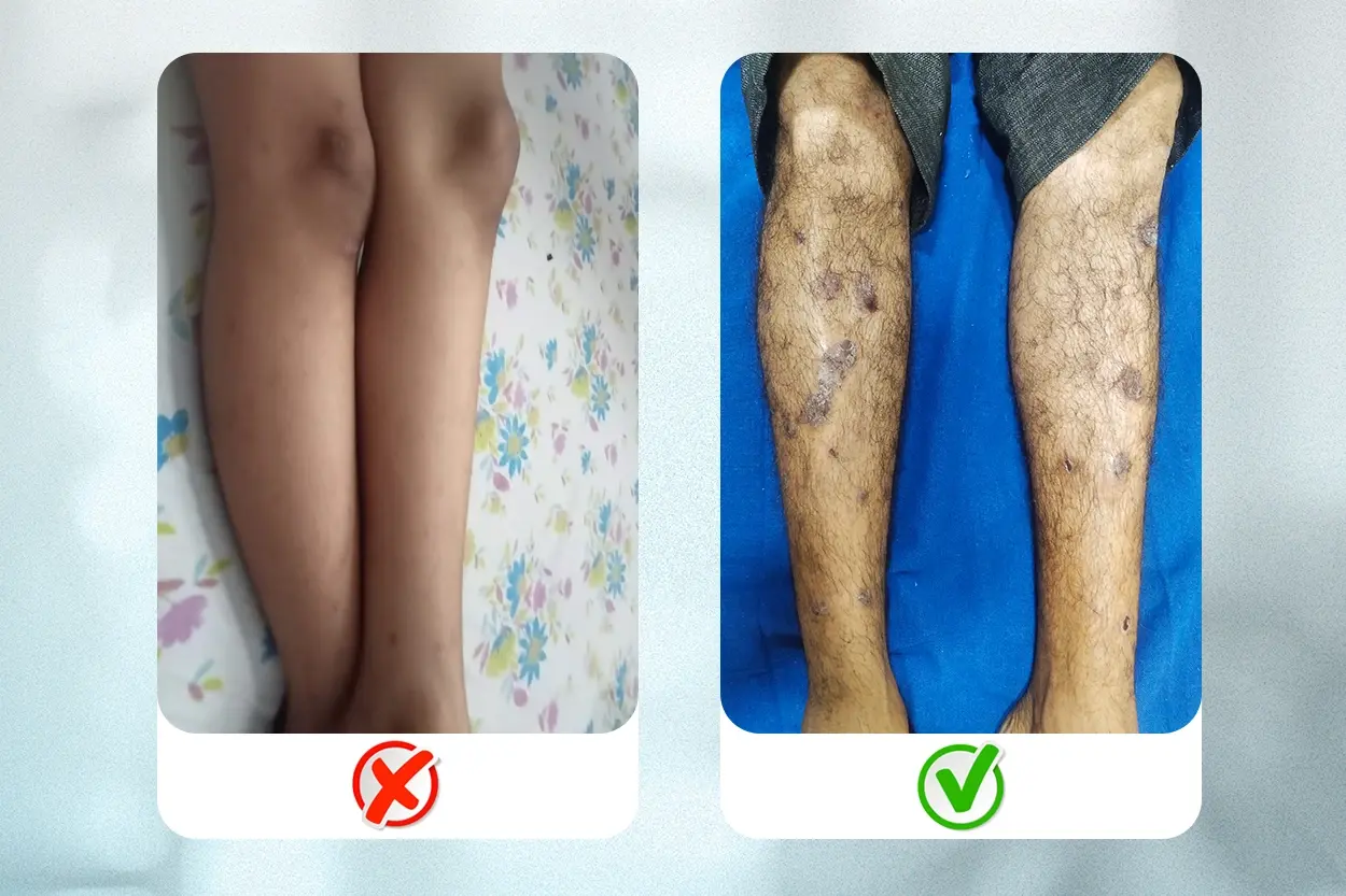 Ditch The Angle - While taking photographs during an online dermatologist consultation