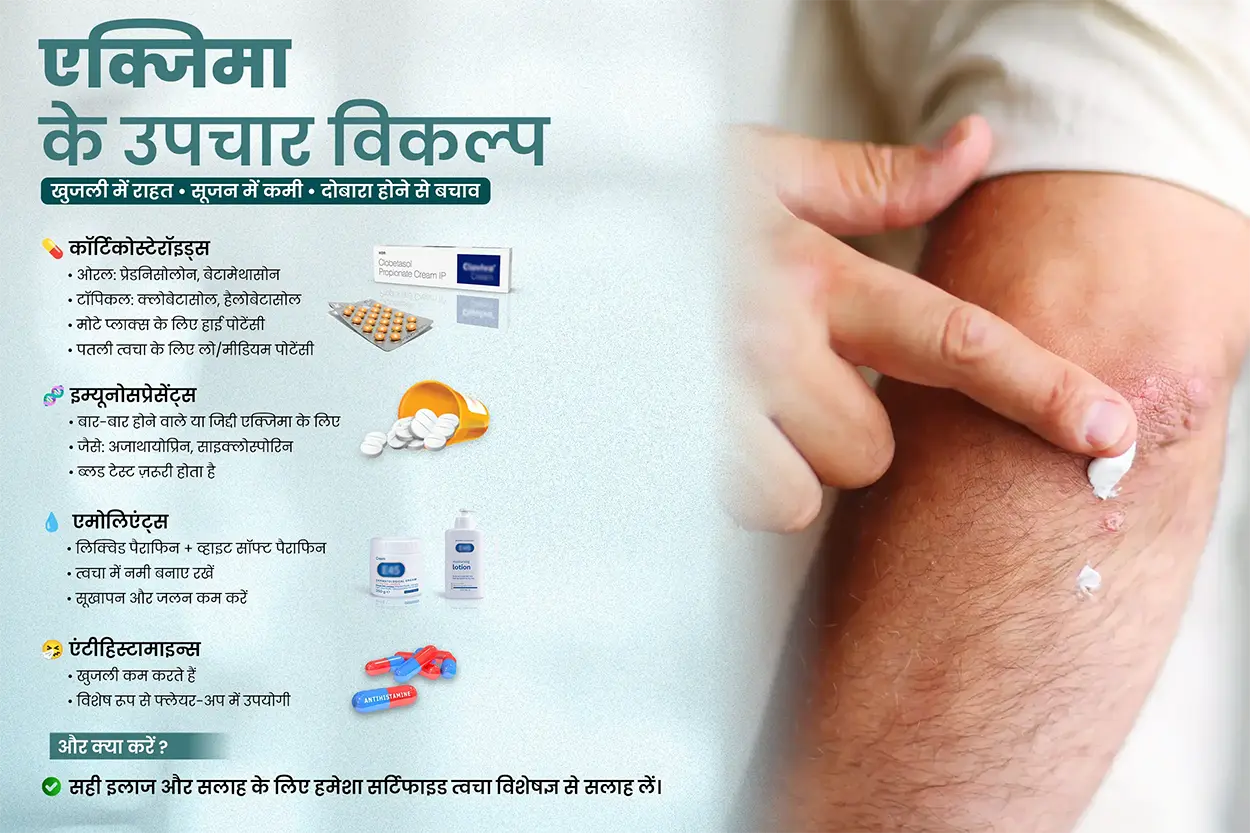 एक्जिमा के उपचार विकल्प - सही इलाज और सलाह के लिए हमेशा सर्टिफाइड त्वचा विशेषज्ञ से सलाह लें। 