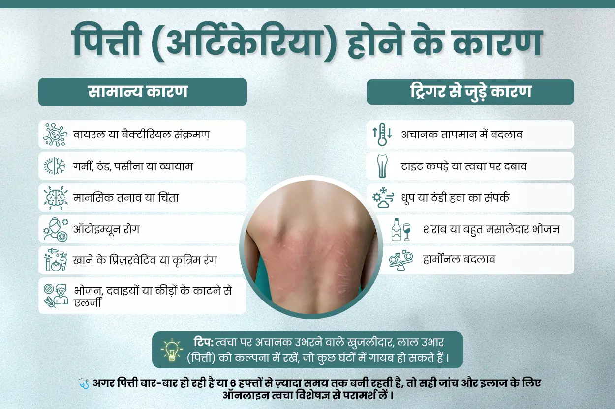 पित्ती (अर्टिकेरिया) होने के कारण - Neodermatologist द्वारा उपचार मार्गदर्शिका