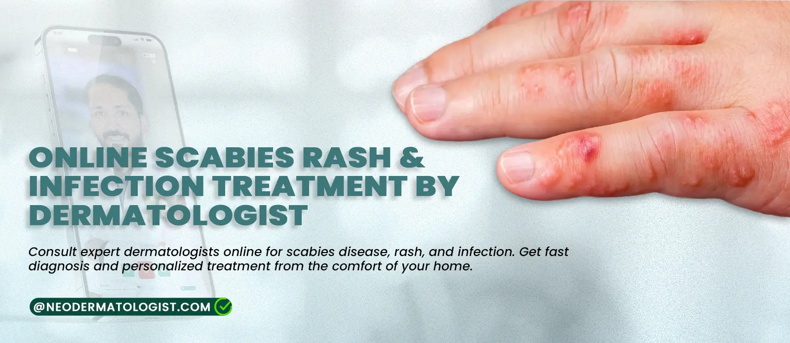 ऑनलाइन खुजली (Scabies) के दाने और संक्रमण का उपचार - त्वचा विशेषज्ञ द्वारा