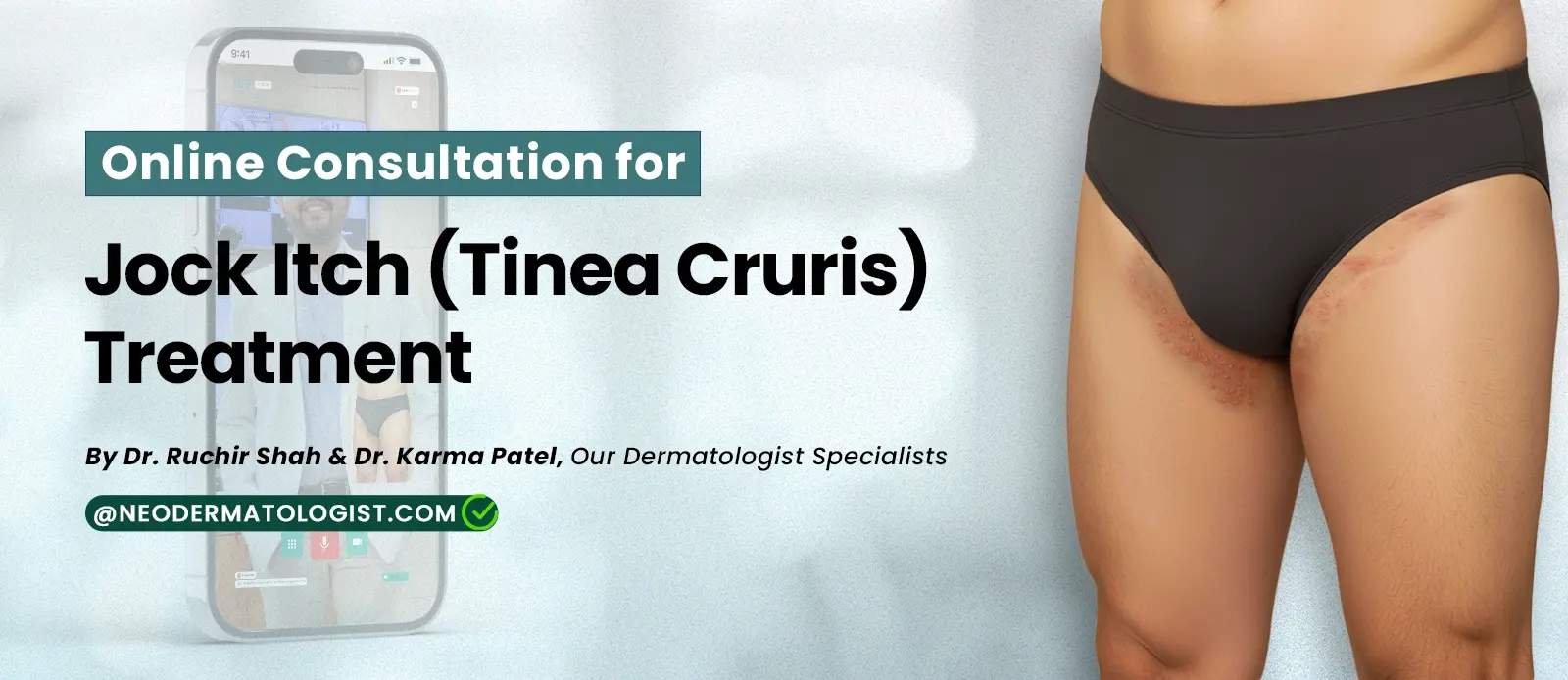 Online Consultation for Jock Itch (Tinea Cruris) Treatment - By Dr. Ruchir Shah & Dr. Karma Patel, Our Dermatologist Specialists 
