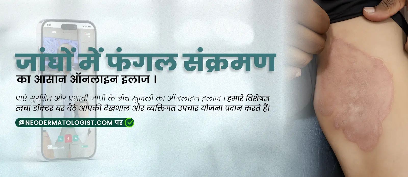 पाएं सुरक्षित और प्रभावी जांघों के बीच खुजली का ऑनलाइन इलाज - 