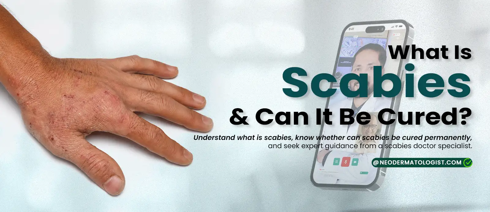 What is scabies and can it be cured? Learn about scabies from Dr. Karma Patel and get expert online treatment at NeoDermatologist.
