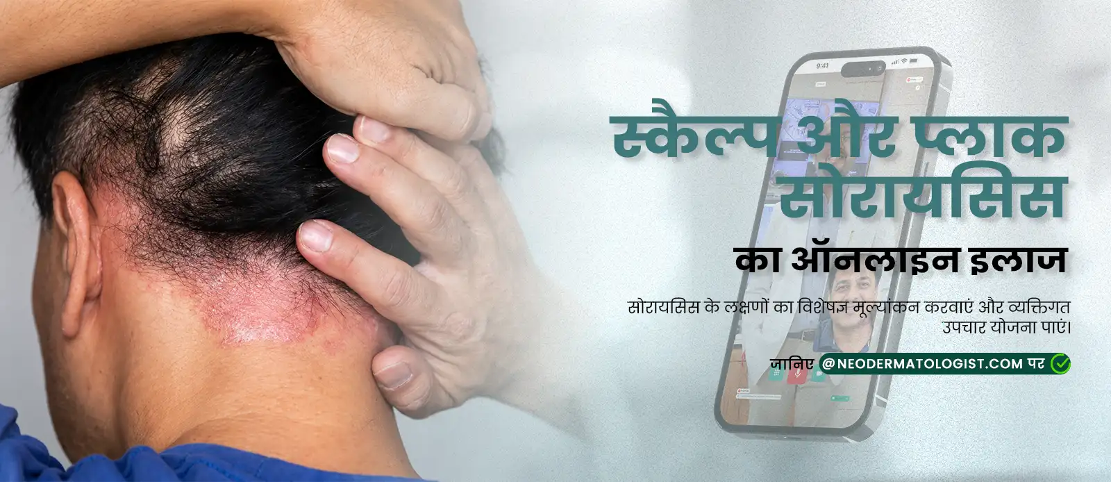 Scalp and plaque psoriasis treatment with online consultation and personalized care from expert dermatologists at NeoDermatologist.