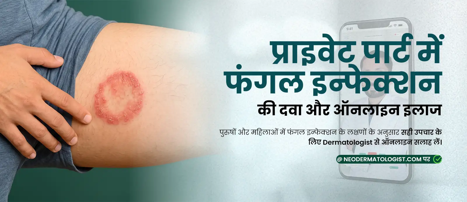 Medicine and online treatment for symptoms of a fungal infection in the private parts.
