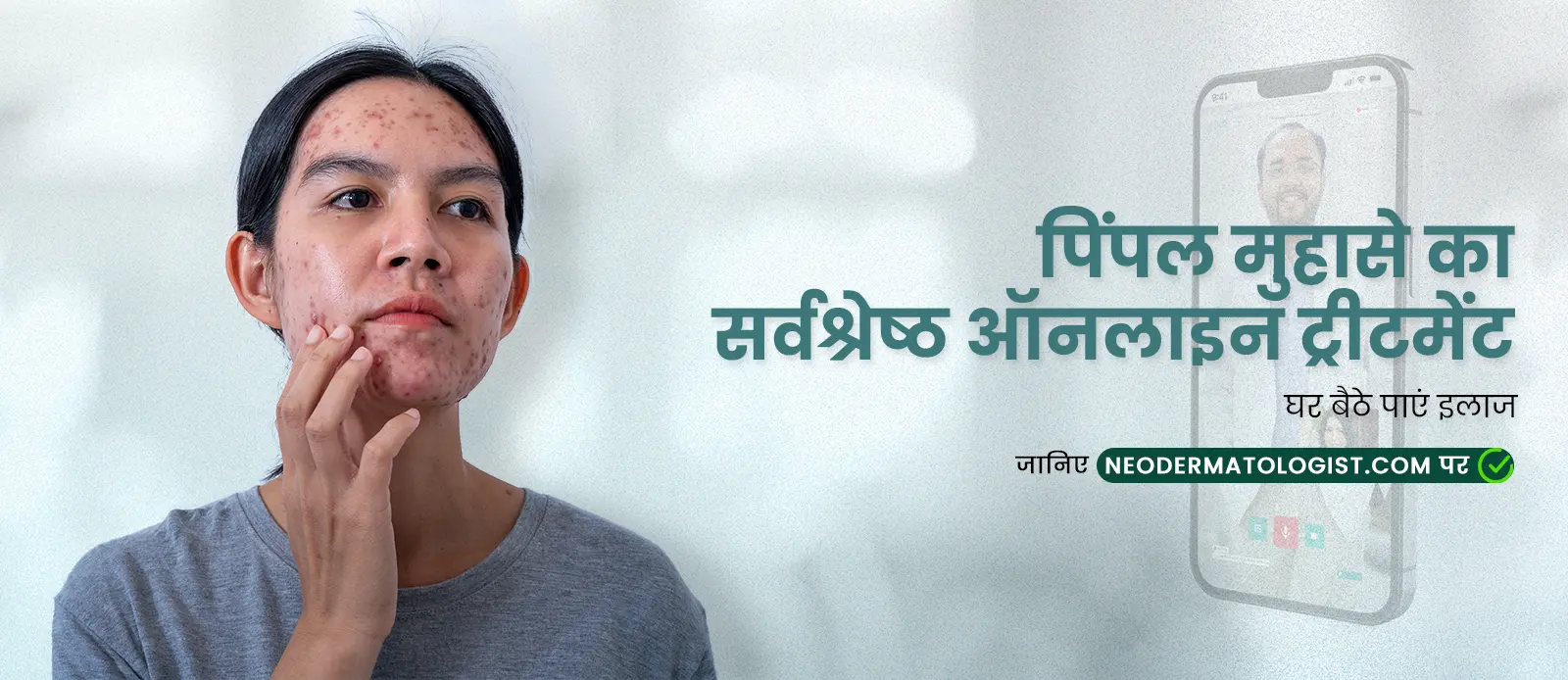 पिंपल मुहासे ऑनलाइन ट्रीटमेंट, पिंपल मुहासे का सर्वश्रेष्ठ ऑनलाइन ट्रीटमेंट – घर बैठे पाएं इलाज