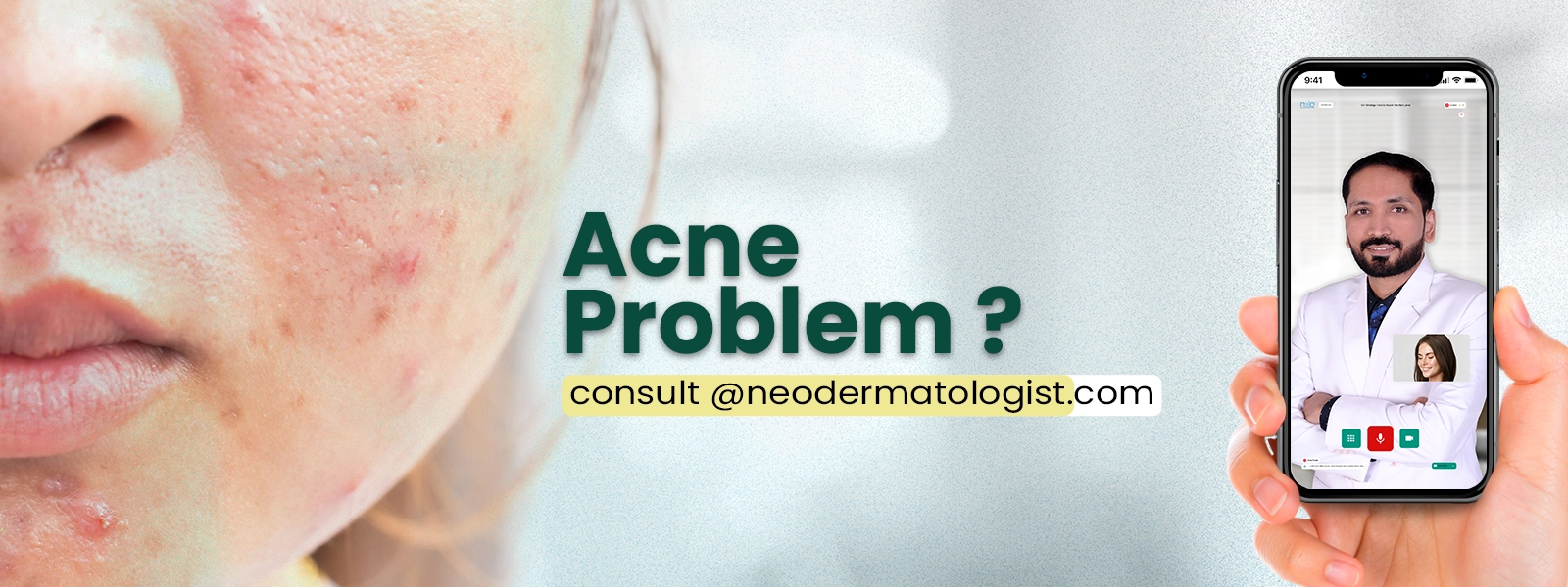 Acne Problem - Consult Dermatologist Online For Acne Treatment