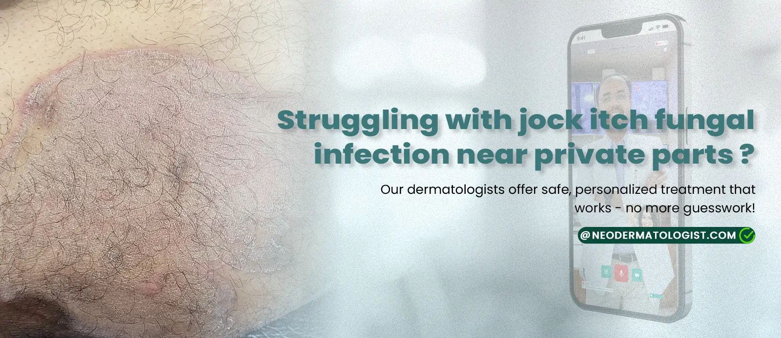 Jock itch fungal infection near private parts - Consult an expert dermatologist online for tinea cruris treatment