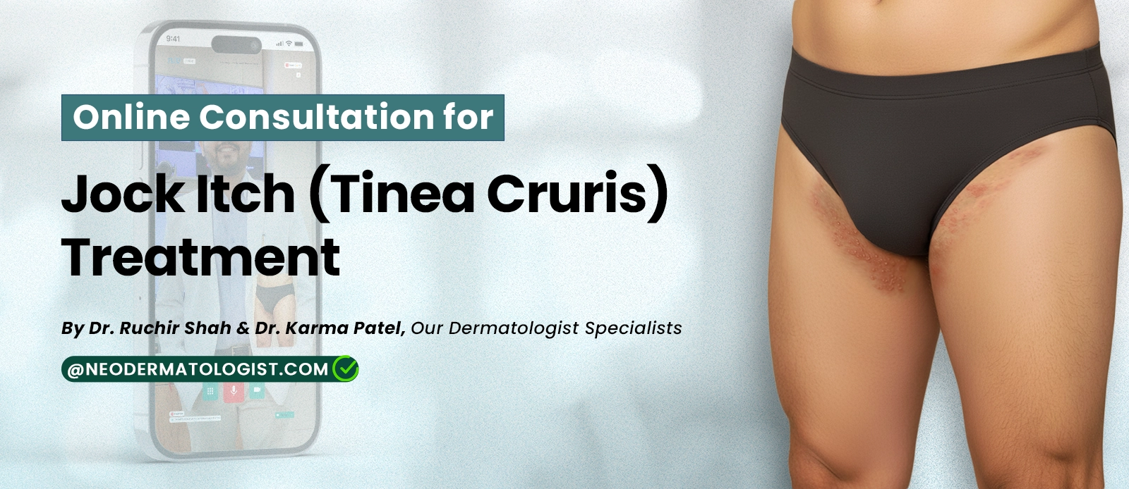 Online Consultation for Jock Itch (Tinea Cruris) Treatment - By Dr. Ruchir Shah & Dr. Karma Patel, Our Dermatologist Specialists