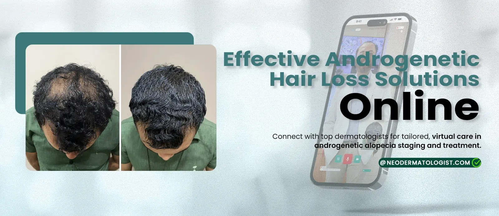 एंड्रोजेनेटिक एलोपेसिया का उपचार - ऑनलाइन डर्मेटोलॉजिस्ट परामर्श प्राप्त करें