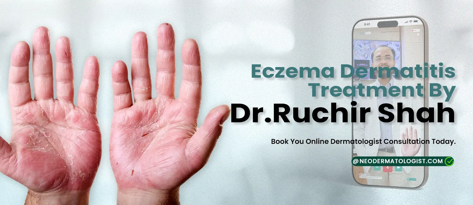 एक्ज़िमा और सेबोरहाइक डर्मेटाइटिस का ऑनलाइन इलाज - डॉ. रुचिर शाह द्वारा | नियोडर्मेटोलॉजिस्ट पर आज ही अपनी ऑनलाइन डर्मेटोलॉजिस्ट कंसल्टेशन बुक करें
