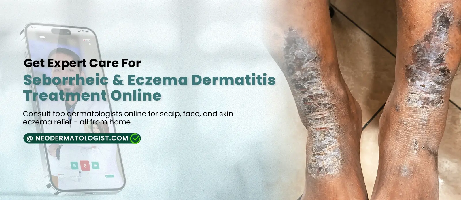 सेबोरहाइक और एक्ज़िमा डर्मेटाइटिस का ऑनलाइन उपचार - स्कैल्प, चेहरे और त्वचा के एक्ज़िमा से राहत के लिए नियोडर्मेटोलॉजिस्ट पर शीर्ष त्वचा विशेषज्ञों से ऑनलाइन परामर्श करें