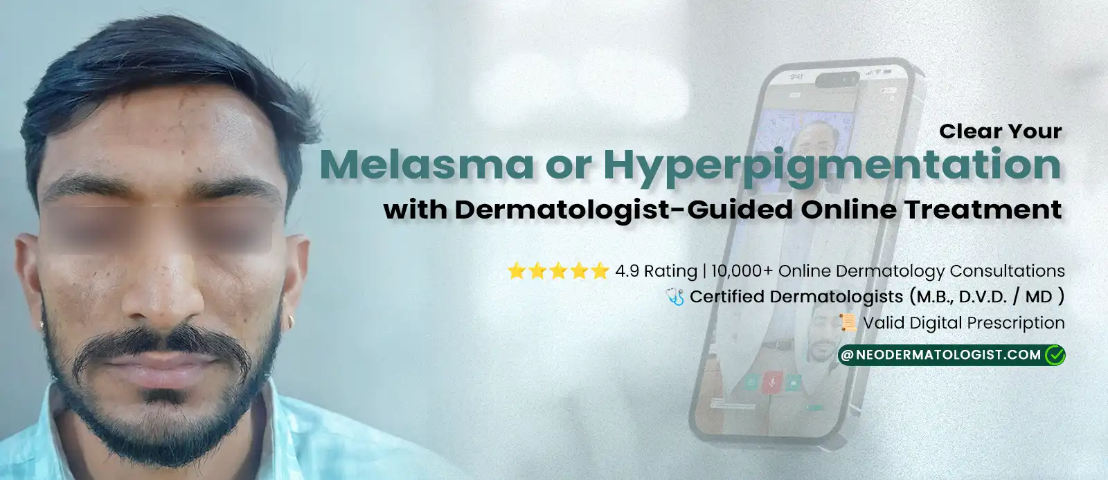 Get Melasma or Hyperpigmentation Treatment Online with Dermatologist Guidance
