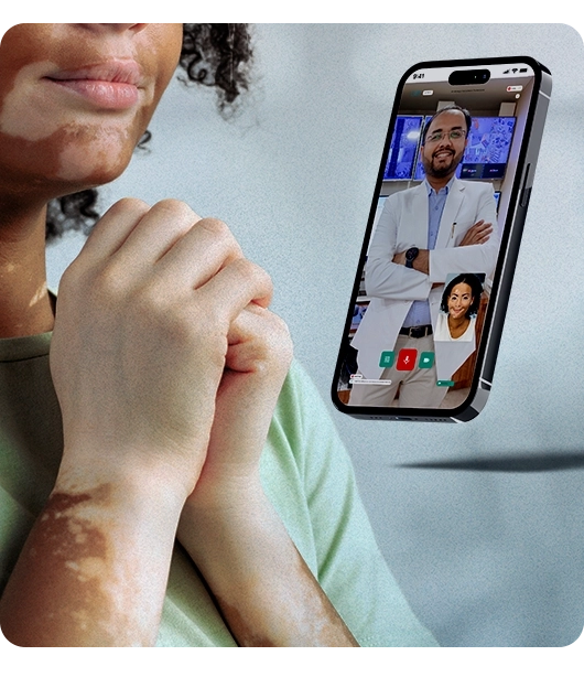 NeoDermatologist का ऑनलाइन विटिलिगो रोग उपचार