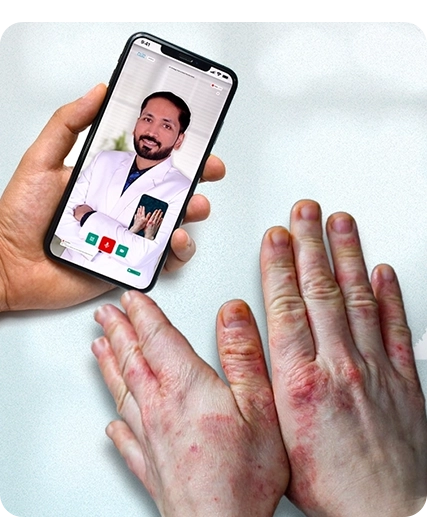 ऑनलाइन एक्जिमा और सेबोरिक ट्रीटमेंट के लिए NeoDermatologist क्यों चुनें?