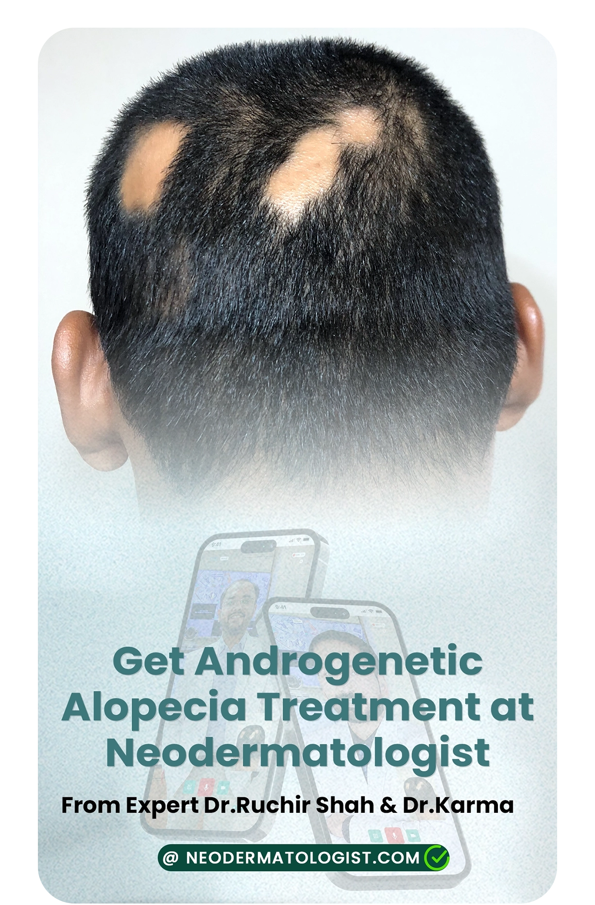 एंड्रोजेनेटिक एलोपेसिया ट्रीटमेंट के लिए नियोडर्मेटोलॉजिस्ट क्यों चुनें