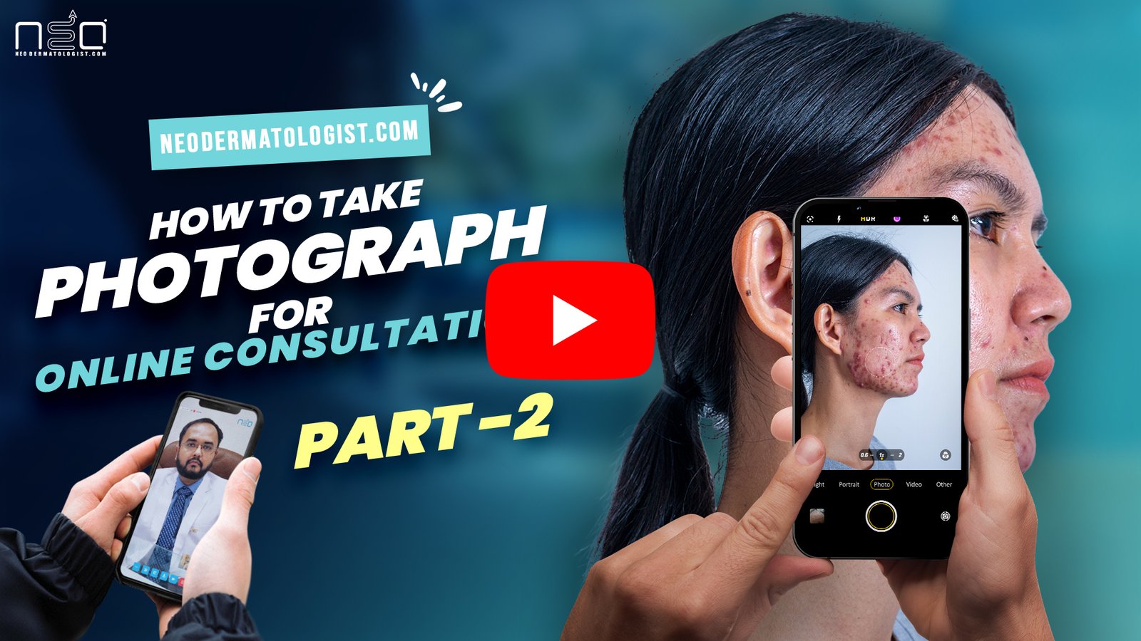 How to take photograph for online consultation ?