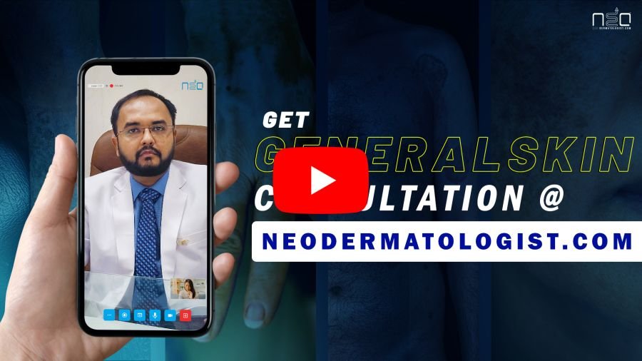 सामान्य त्वचा रोगों के उपचार के लिए ऑनलाइन त्वचा विशेषज्ञ से परामर्श लें।